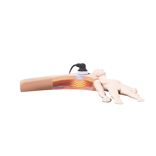 Crear una experiencia AR educativa sencilla sobre DIATERMIA para estudiantes de Fisioterapia. Mostrar un cuerpo humano simplificado, un aplicador de diatermia sobre el tejido y representar visualmente la energía electromagnética entrando al tejido y produciendo un aumento de temperatura. Incluir cuatro etiquetas: DIATERMIA → ENERGÍA ELECTROMAGNÉTICA → AUMENTO DE TEMPERATURA → RESPUESTA FISIOLÓGICA. Diseño limpio, educativo y visual.