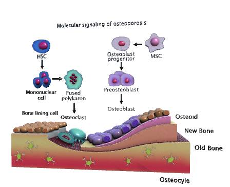 Molecular signaling of osteoporosis